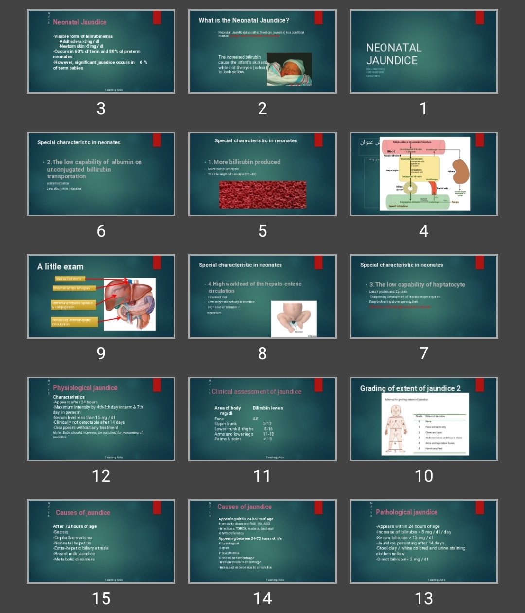 پاورپوینت NEONATAL JAUNDICE