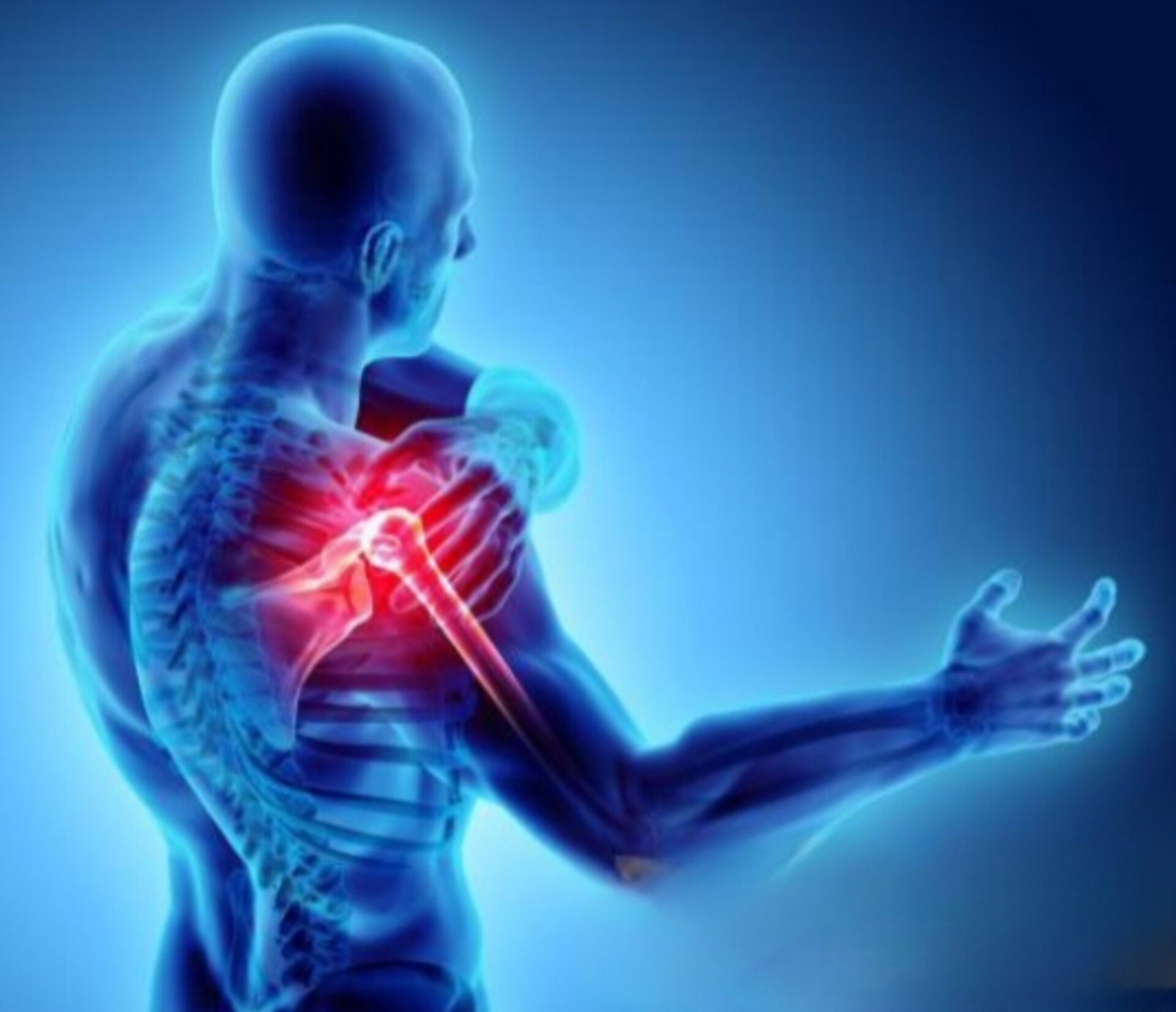 آسیب شناسی عضلانی