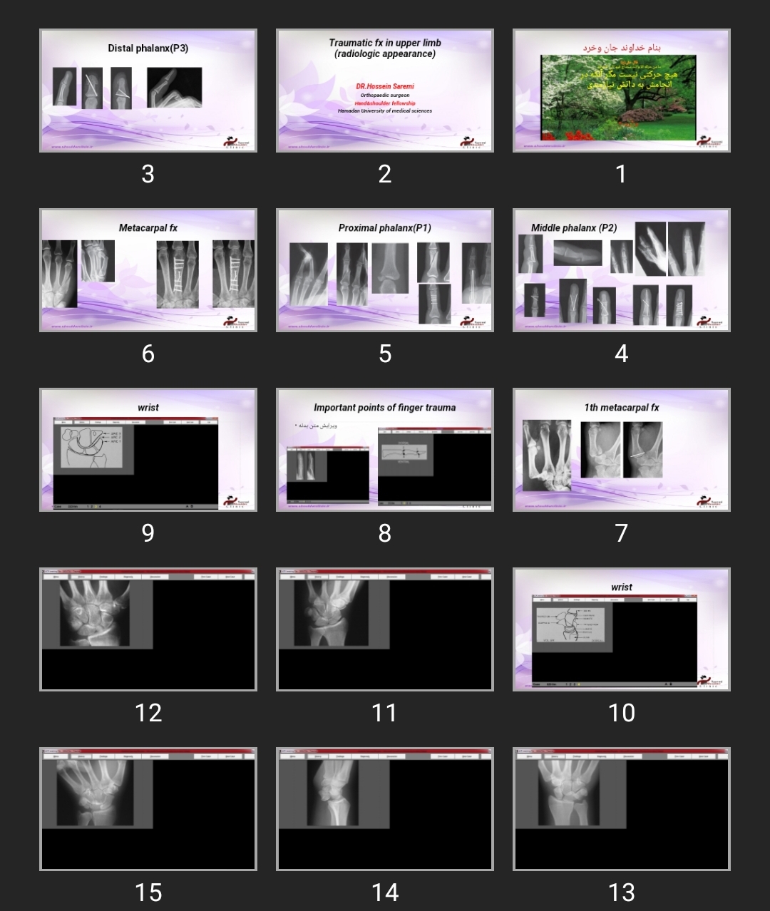 پاورپوینت Traumatic fx in upper limb (radiologic appearance)