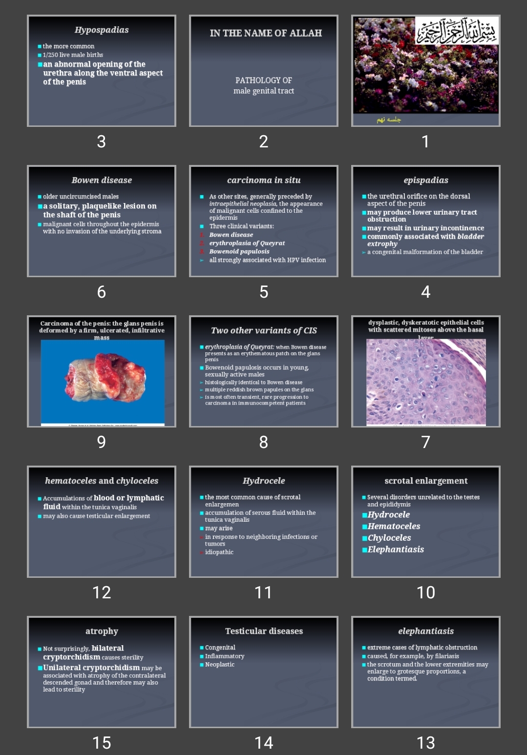 پاورپوینت PATHOLOGY OF male genital tract