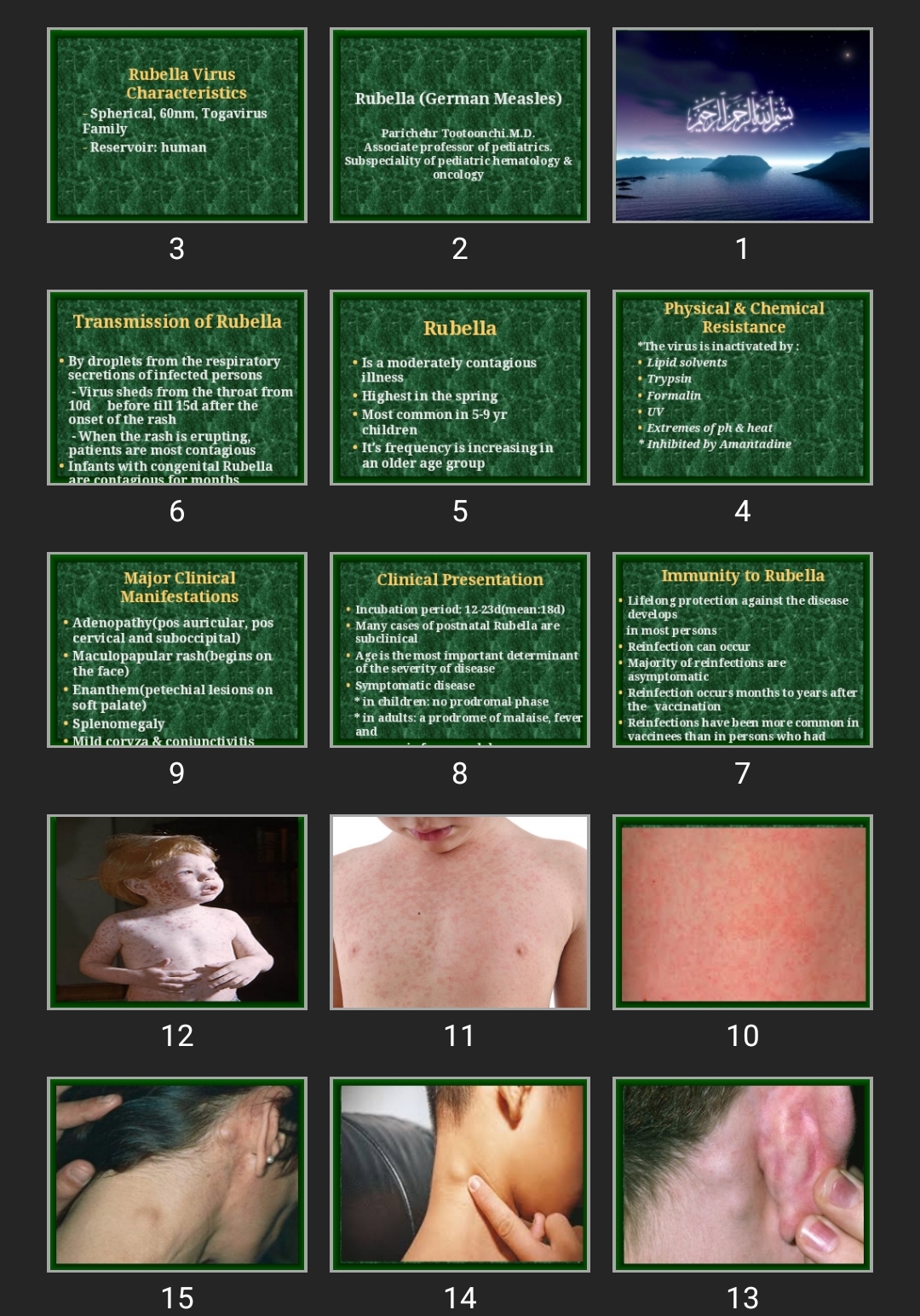 پاورپوینت Rubella (German Measles)