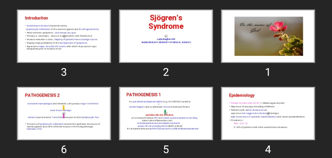 پاورپوینت Sjögren’s Syndrome