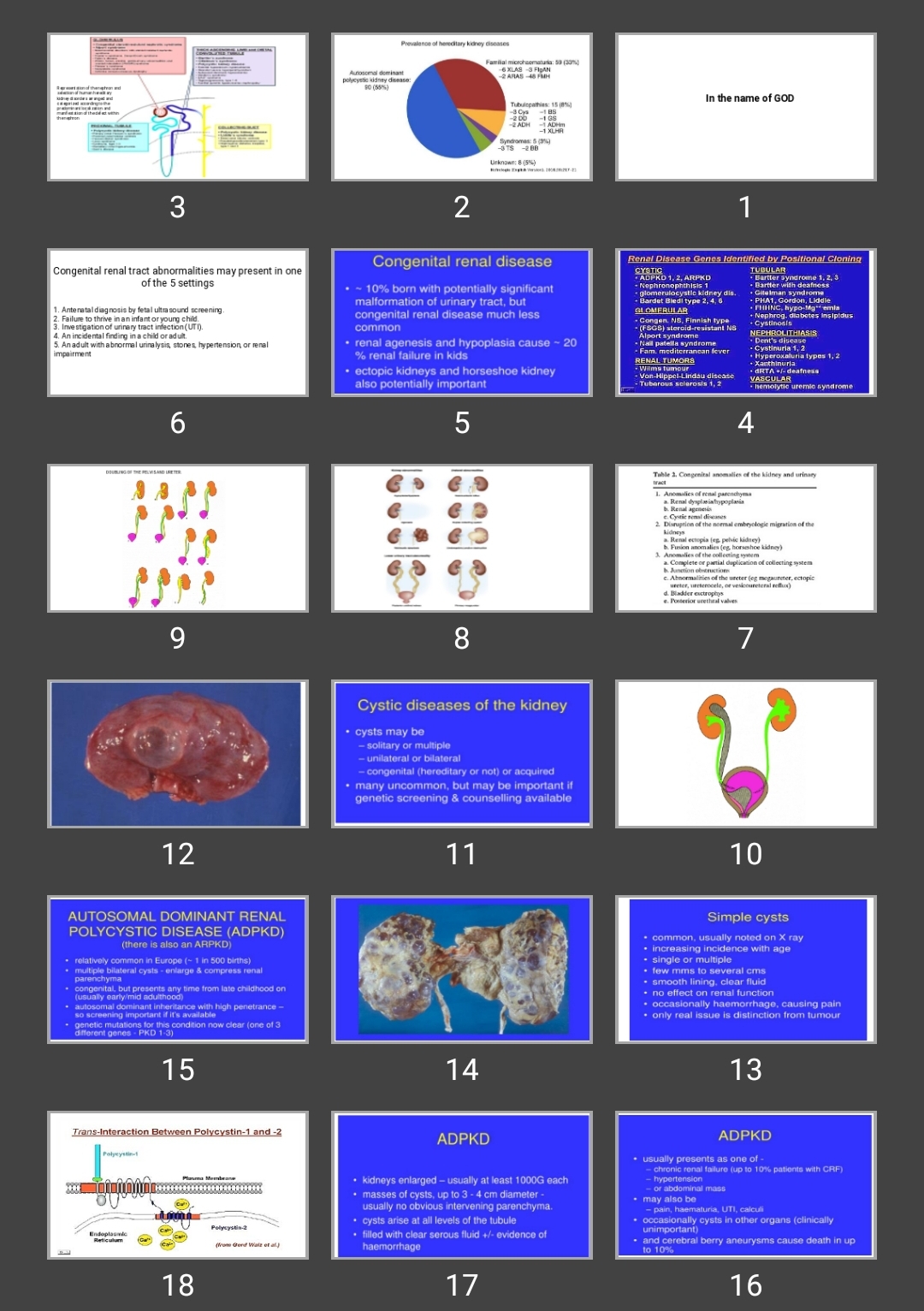 پاورپوینت hereditary renal diseases